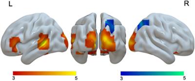 Greater Similarity Between L1 and L2’s Brain Network in Adults Than in Children